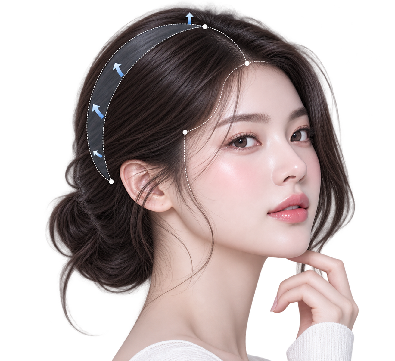 두상성형