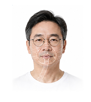 양압기 치료가 어려운 경우