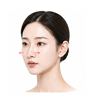 보형물이 이동하는 경우