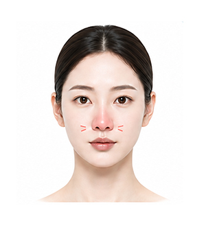 코가 빨갛거나 돌처럼 단단해진 경우