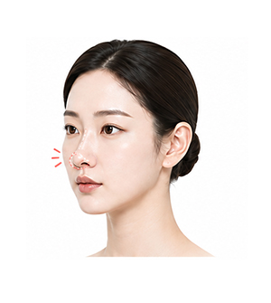 코가 땅기고 코끝이 딱딱해지는 경우